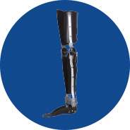 FullStride Case Study I - Extending the Performance of a Stance Control Orthosis